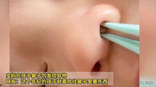 宝宝鼻子内图片大全,揭秘鼻腔内奥秘