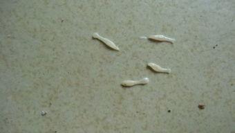 大便拉出虫子图片,大便虫子图片揭示健康隐患