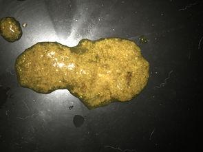 大便拉出虫子图片,大便虫子图片揭示健康隐患