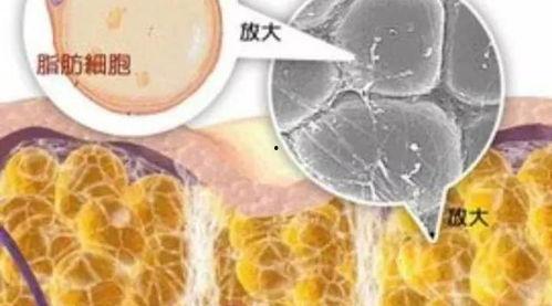 脂肪的图片,揭秘健康脂肪的神奇力量