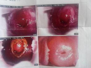 日本糜烂图片,从糜烂图片看深层问题