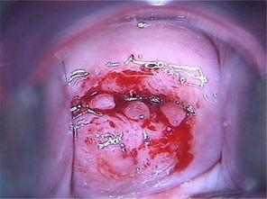 日本糜烂图片,从糜烂图片看深层问题