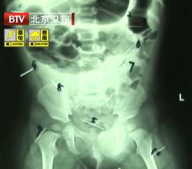 取钢针视频,钢针制作过程揭秘