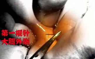 取钢针视频,钢针制作过程揭秘