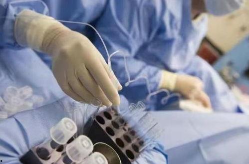 做试管婴儿视频,从视频看辅助生殖技术