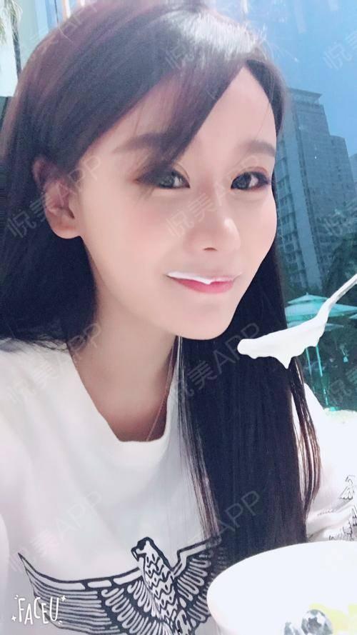 自然双眼皮图片大全,图片大全带你领略双眼皮之美