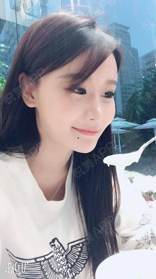 自然双眼皮图片大全,图片大全带你领略双眼皮之美