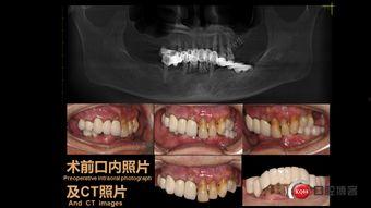 白骨观实修引导视频,揭秘身心净化之旅
