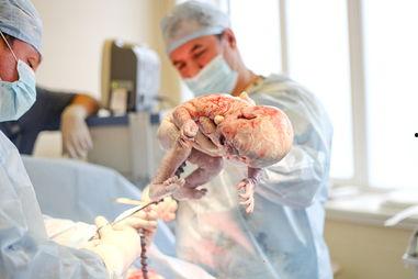 分娩过程视频,揭秘母爱奇迹的瞬间